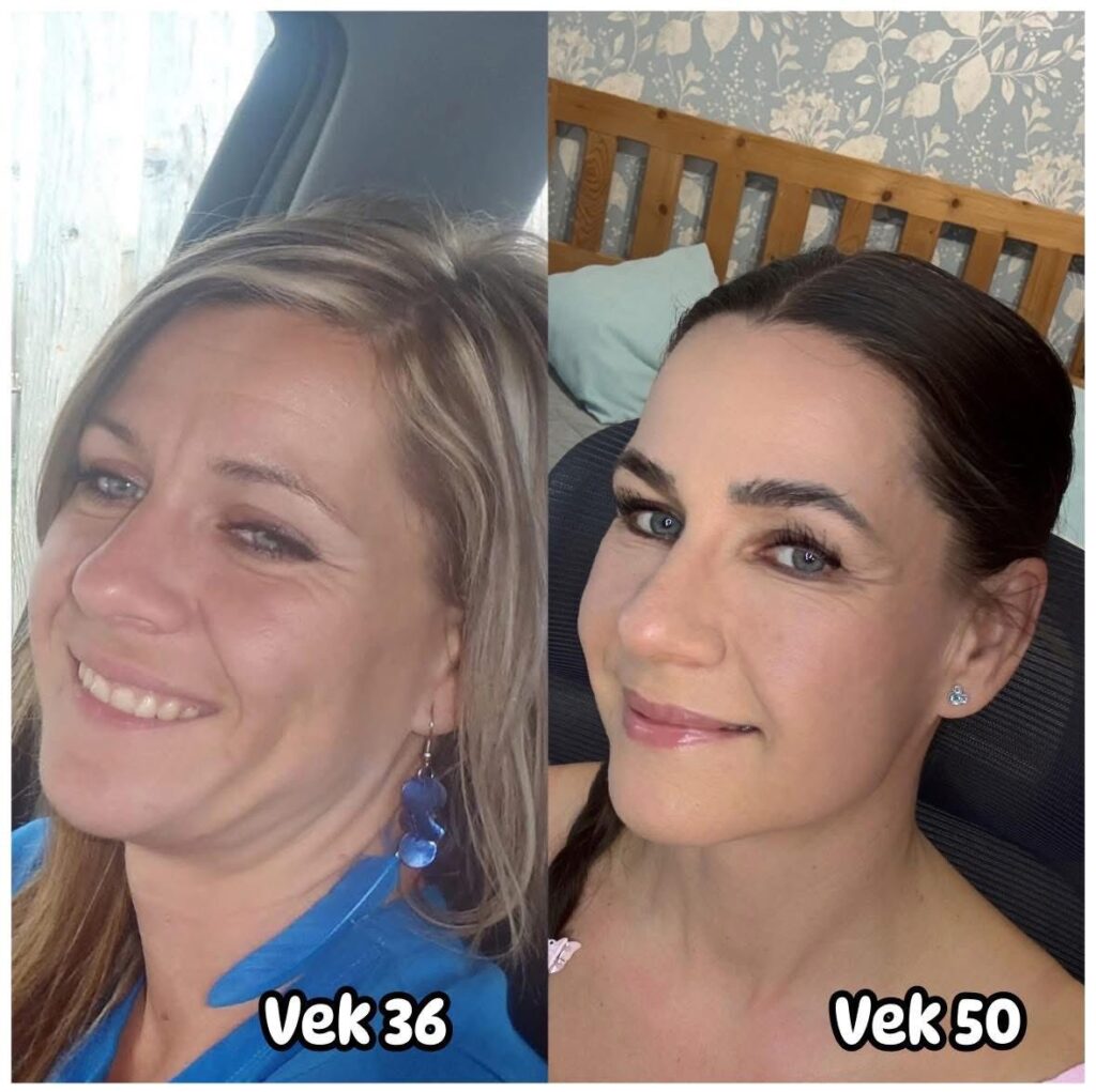 Tvárová gymnastika alebo masáž tváre? Čo skutočne funguje na vyhladenie vrások?